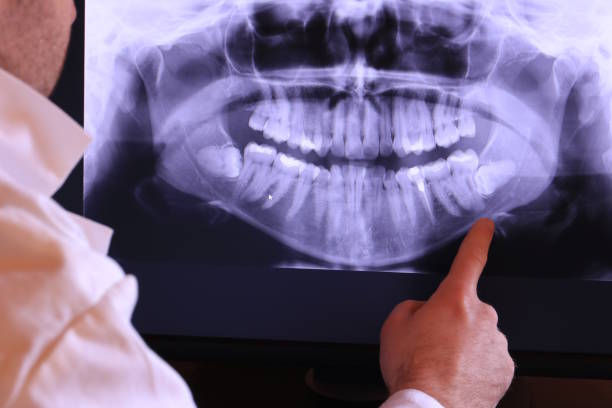 Tooth Infection Emergency Dentist in TN