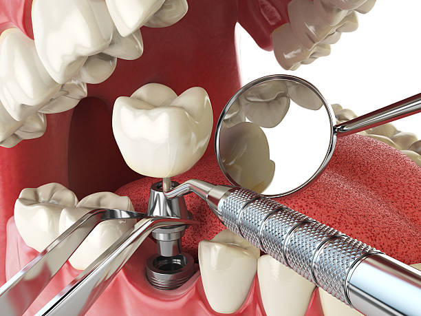 Best Dentist for Tooth Abscess  in Bluff City, TN